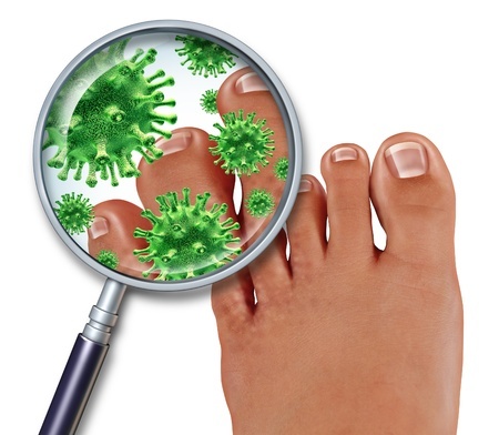 Treatment for fungal infections - Clear Medical