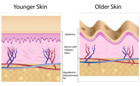 Diagram showing the different layers of old and younger skin Diagram showing the different layers of old and younger skin