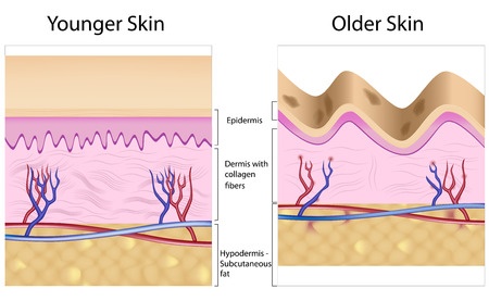 Diagram showing the different layers of old and younger skin