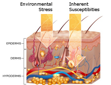 Diagram of different layers of skin showing epidermis, dermis, and hypodermis. 