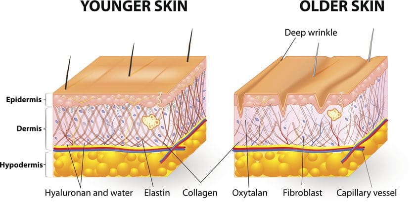 Radiofrequency Stimulates Fibroblasts Clear MedicalAgeing 